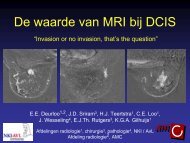 De waarde van MRI bij DCIS - NKI-AVL