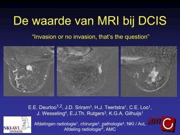 De waarde van MRI bij DCIS - NKI-AVL