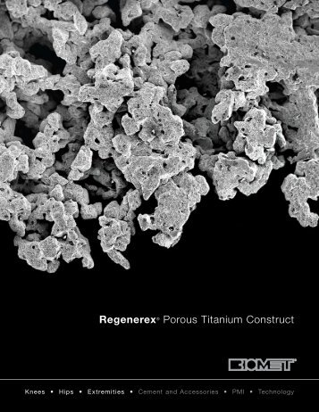 RegenerexÂ® Porous Titanium Construct - Biomet