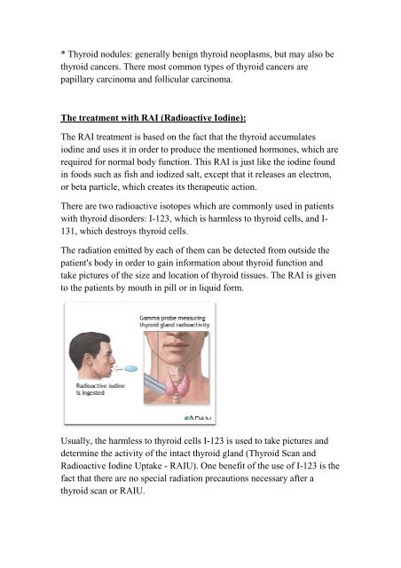 Radioactive Iodine use for thyroid problems