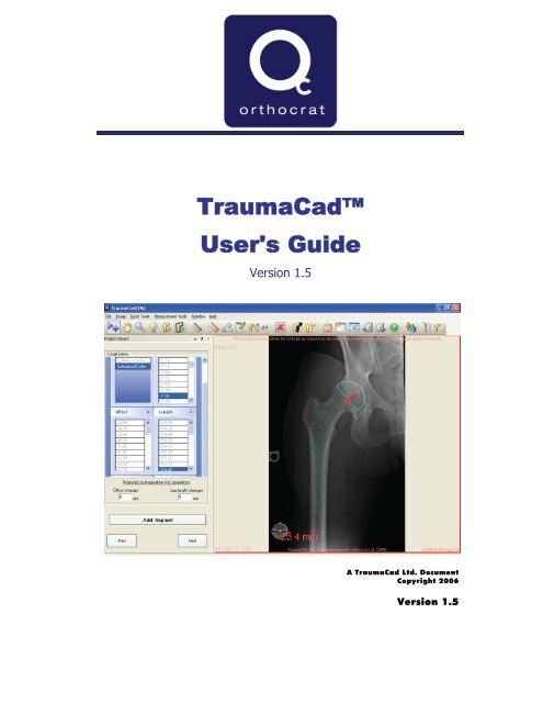 TraumaCad 1.5 User's Guide.pdf - Voyant Health