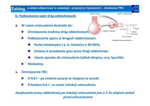 UkÅad oddechowy w czasie znieczulenia - Waldemar MachaÅa