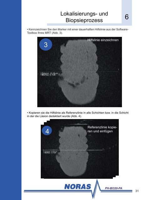 und Biopsiesystem PH-BI320-PA - NORAS MRI products GmbH