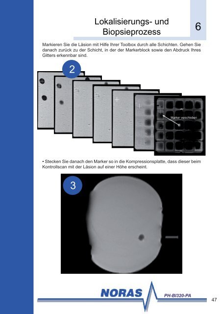 und Biopsiesystem PH-BI320-PA - NORAS MRI products GmbH