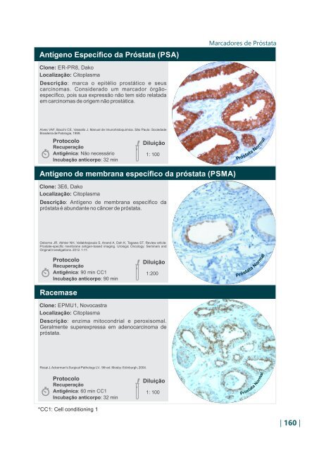 antígeno de membrana específico de próstatas antígeno de membrana específico de próstatas
