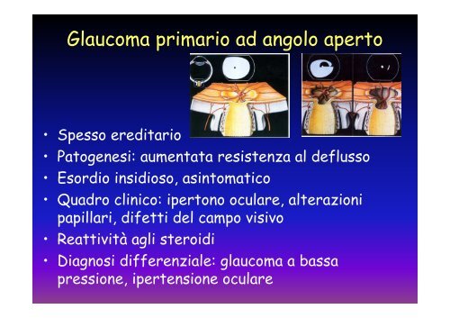 5_Il glaucoma la diagnosi - ABCsalute.it