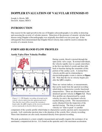 doppler evaluation of valvular stenosis #3 - Echo in Context