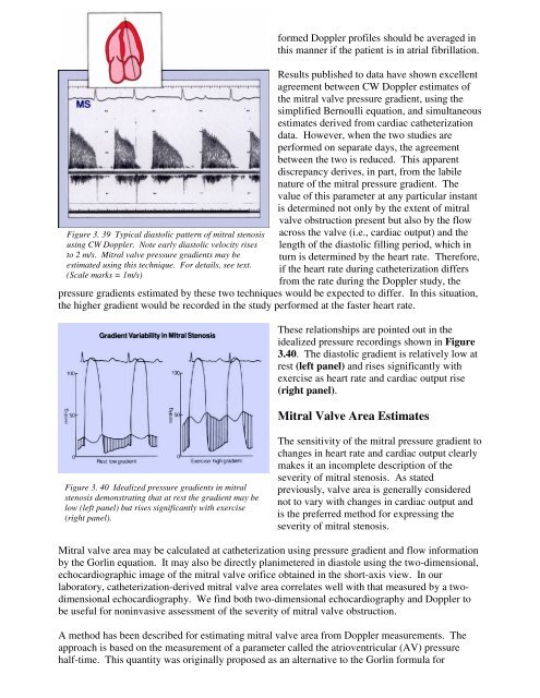 doppler evaluation of valvular stenosis #3 - Echo in Context