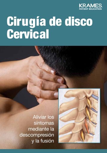 considere una cirugía de disco cervical. - Veterans Health Library