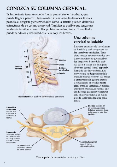 considere una cirugía de disco cervical. - Veterans Health Library