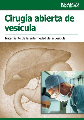 Cirugía abierta de vesícula - Veterans Health Library