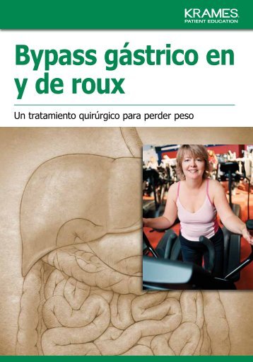 Bypass gástrico en y de roux - Veterans Health Library