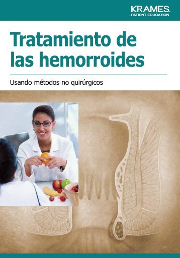 Tratamiento de las hemorroides - Veterans Health Library