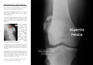 Bipartite Patella Information - Knee Surgeon