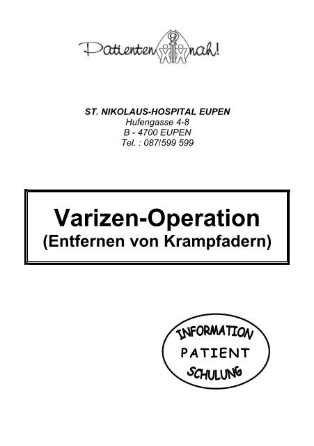 Varizen-Operation