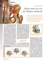 Lumboischialgie – Wenn mehr als nur der Rücken schmerzt