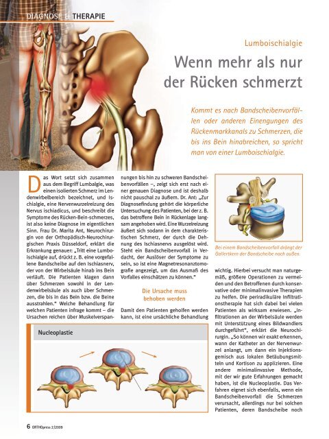 Lumboischialgie – Wenn mehr als nur der Rücken schmerzt