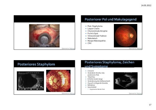 FundusverÃ¤nderung bei hoher Myopie Workshop - Optometrie ...