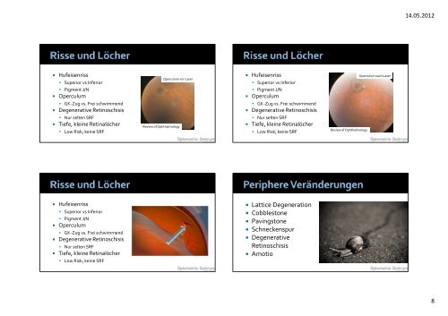 FundusverÃ¤nderung bei hoher Myopie Workshop - Optometrie ...
