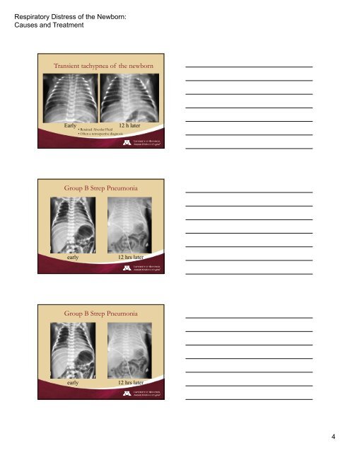 Respiratory Distress of the Newborn: Causes and ... - Trinity Health