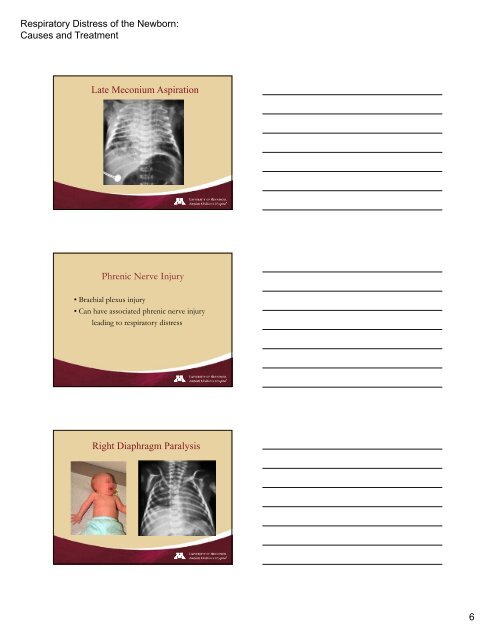 Respiratory Distress of the Newborn: Causes and ... - Trinity Health