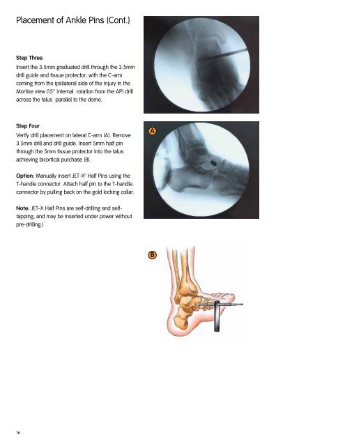 Jet-X Central Technique.pdf - Bonerepmedical.com