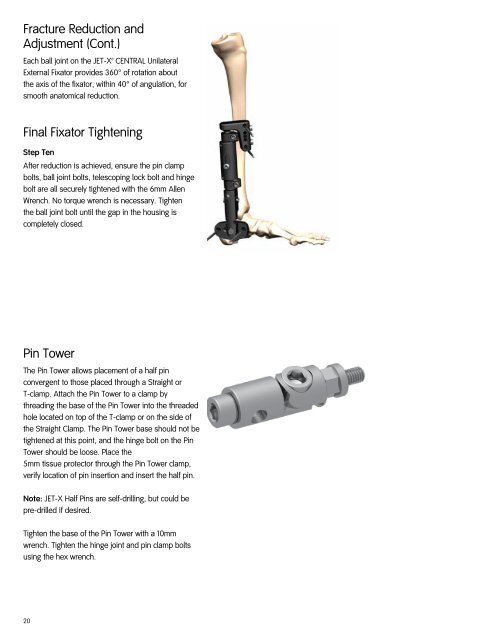 Jet-X Central Technique.pdf - Bonerepmedical.com