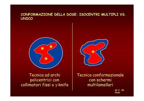 Radioterapia Stereotasica