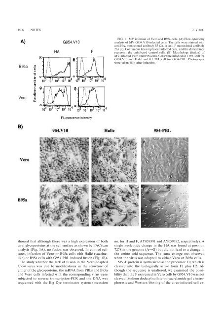 SOUCHES AFRICAINES DU VIRUS DE LA ROUGEOLE : ETUDE ...