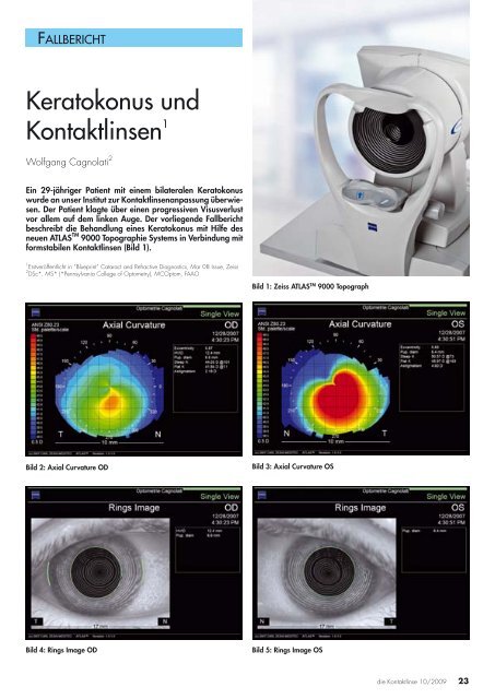 Download - Optometrie Cagnolati