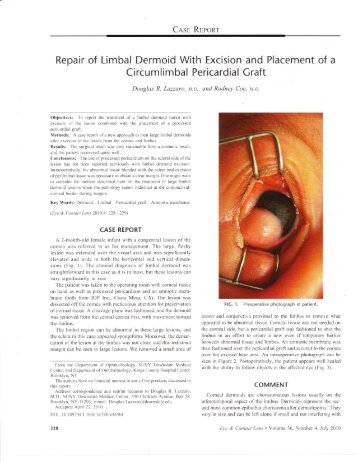 Repair of Limbal Dermoid With Excision and ... - Eyetube.net