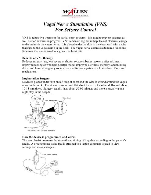 Vagal Nerve Stimulation (VNS)