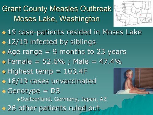 Presentation of Grant County Measles Outbreak