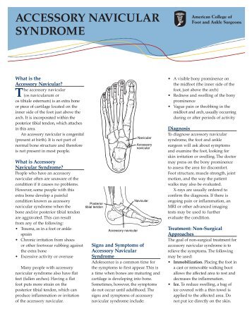 ACCESSORY NAVICULAR SYNDROME