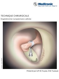 STAPEDOTOMIE transplatinaire calibrÃ©e - MicroFrance