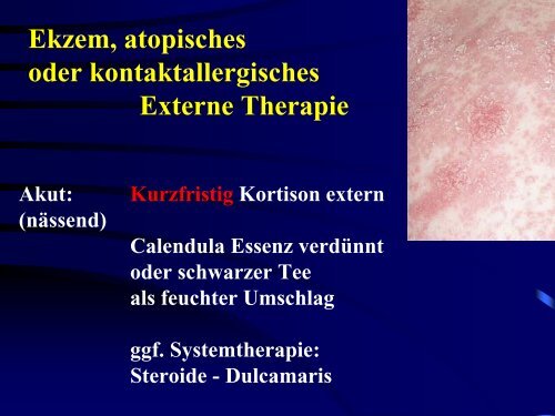 Ekzeme (Vortrag) - Derma-Hattingen