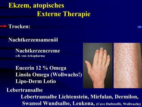 Ekzeme (Vortrag) - Derma-Hattingen