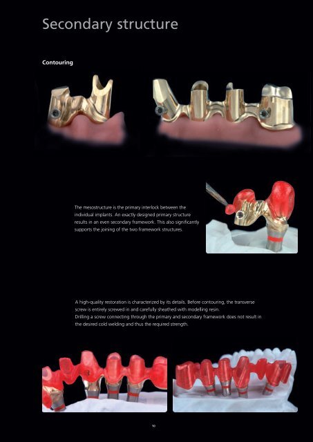 Gold-Standard for Implant Superstructures Special Edition