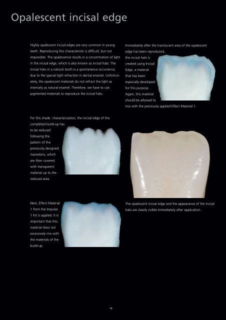 Shade characteristics of natural teeth