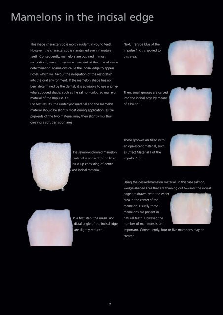 Shade characteristics of natural teeth