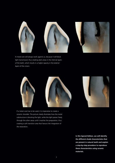 Shade characteristics of natural teeth