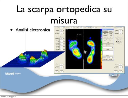 neuro-osteoartropatia di Charcot - orthoswiss