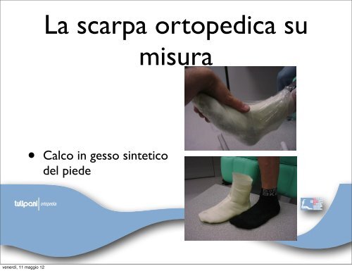 neuro-osteoartropatia di Charcot - orthoswiss