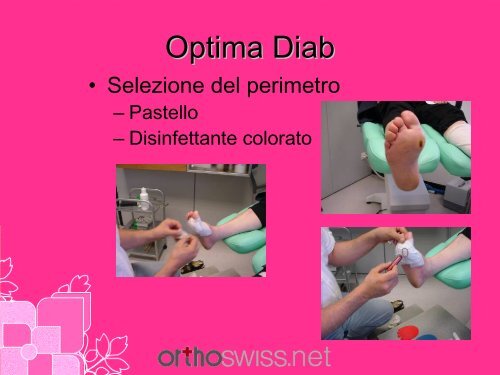 Diab - orthoswiss