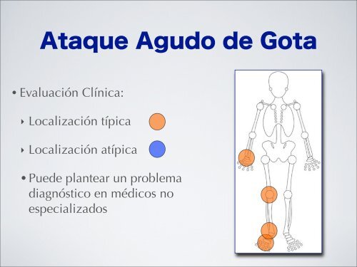 ARTRITIS METABÃLICAS HIPERURICEMIA Y GOTA - eTableros