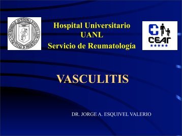 Vasculitis de Grandes y Medianos Vasos - eTableros