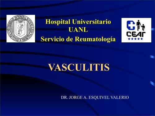 Vasculitis de Grandes y Medianos Vasos - eTableros