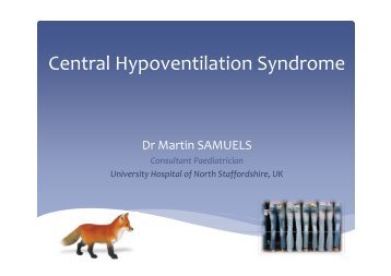 central cogenital hypoventilation syndrome central cogenital hypoventilation syndrome