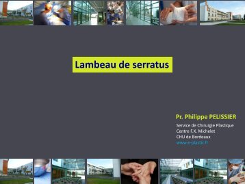 Lambeau de serratus - e-plastic.fr