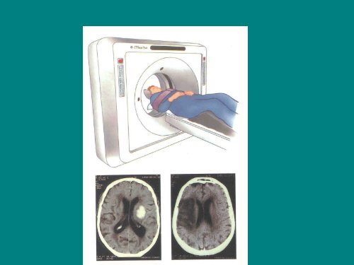 Time i Brain - Utbildning primÃ¤rvÃ¥rd och kommun, E.B